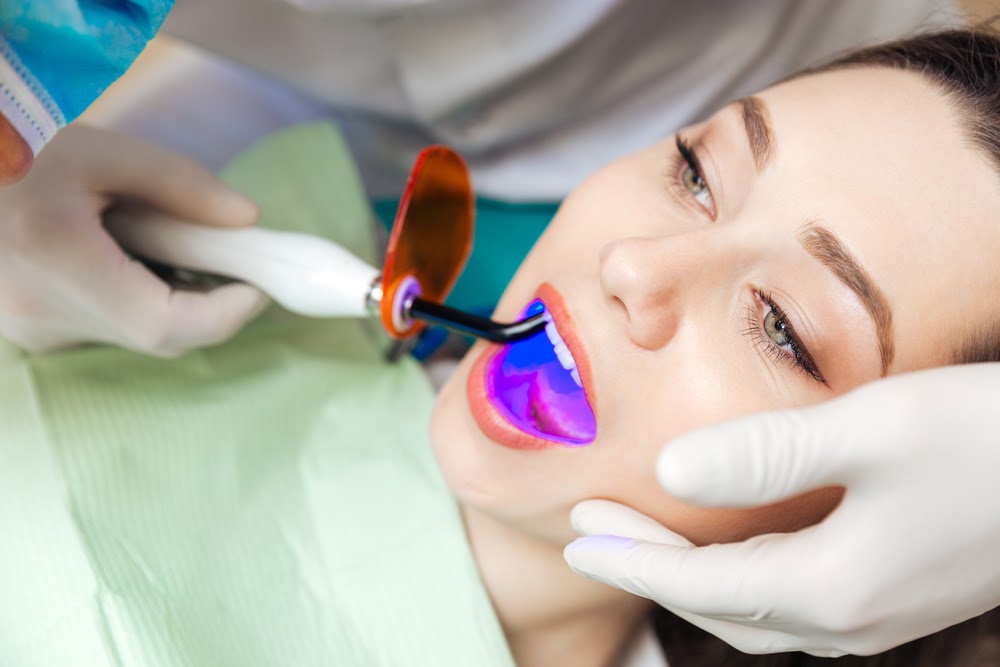 Cosmetic Benefits of Laser&nbsp;Dentistry